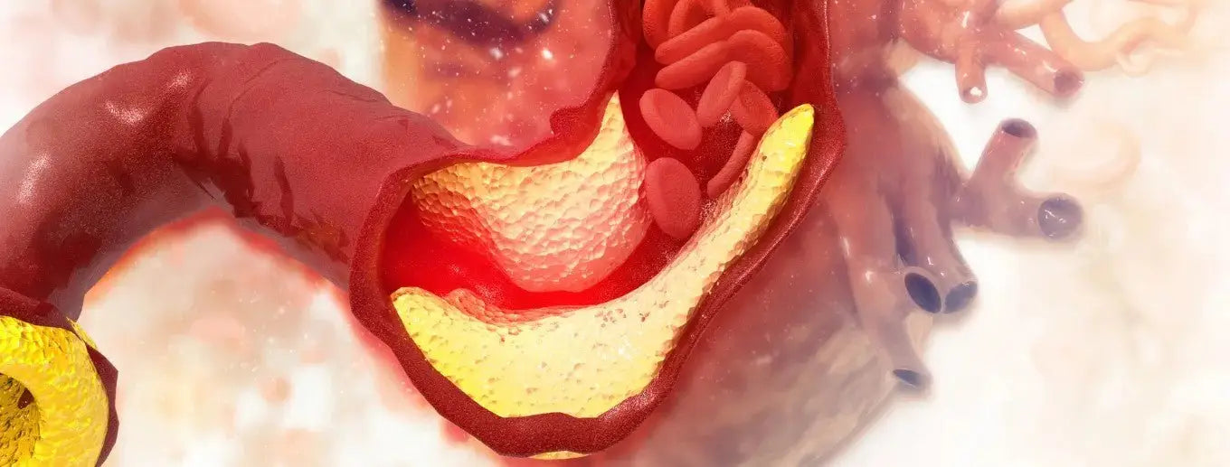 How to Decrease My Cholesterol Level?