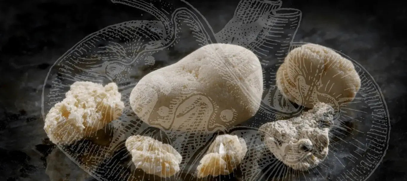 What Causes Kidney Stones? How to Avoid Them?