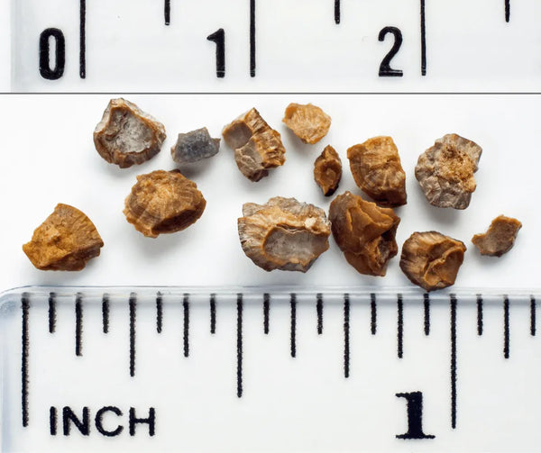 Kidney Stone