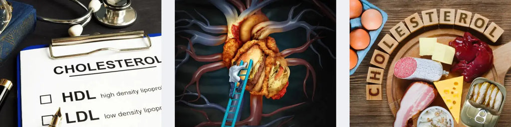 Cholesterol diet health