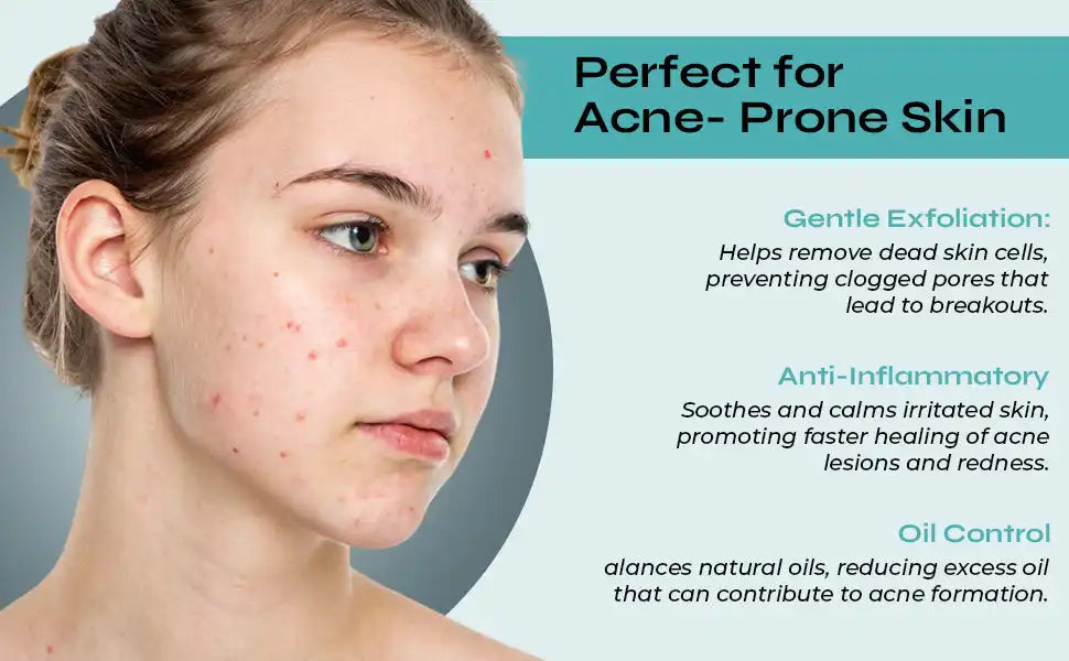 Acne treatment benefits.